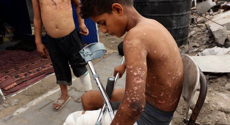 El niño palestino Zain Al-Anqar resultó herido por la explosión de un sospechoso resto de guerra en Gaza.